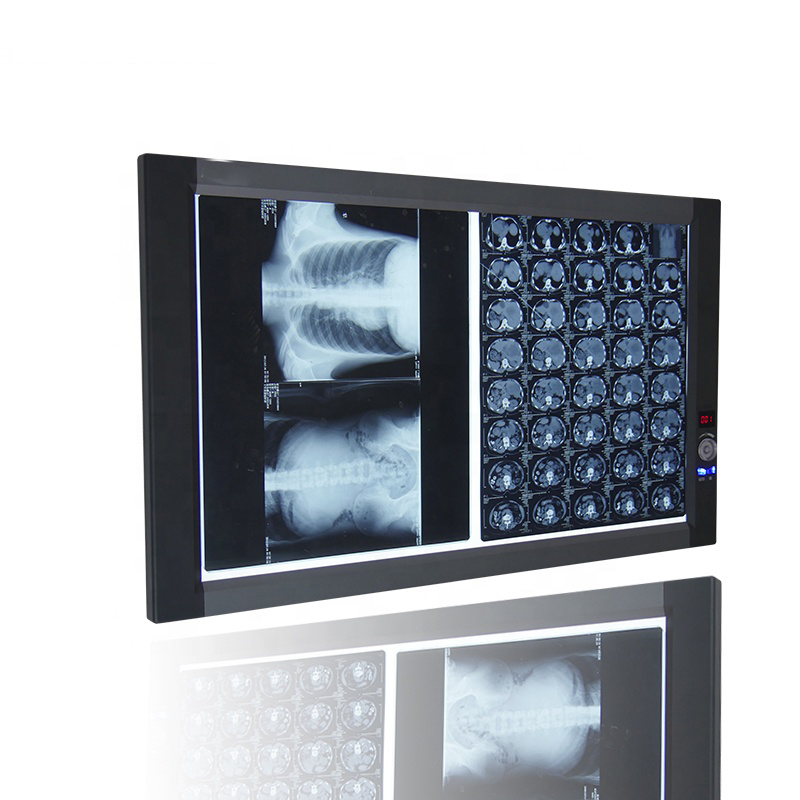 Cuadro de visualización de película de rayos X LED (2B)