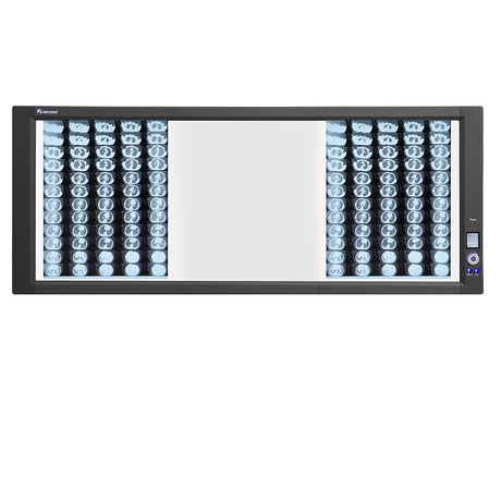 Caja de vista de película de rayos X LED (3A)